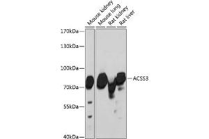 Western blot analysis of extracts of various cell lines, using  antibody (ABIN6131412, ABIN6136470, ABIN6136471 and ABIN6217898) at 1:3000 dilution. (ACSS3 Antikörper  (AA 30-280))