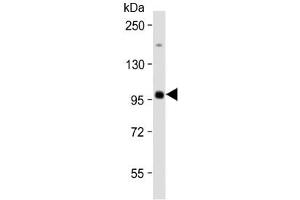 Western blot testing of human Raji cell lysate with MAP4K1 antibody at 1:2000. (MAP4K1 Antikörper)