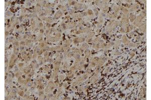 ABIN6257460 and ABIN6273388 at 1/100 staining Human liver tissue by IHC-P. (RIOK2 Antikörper  (Internal Region))