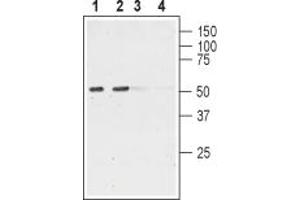 anti-Cholinergic Receptor, Nicotinic, alpha 6 (CHRNA6) (AA 35-47), (Extracellular) antibody
