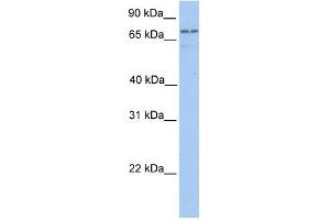 Transglutaminase 7 antibody used at 1 ug/ml to detect target protein. (Transglutaminase 7 Antikörper  (C-Term))
