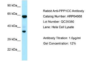 Western Blotting (WB) image for anti-Protein Phosphatase 1, Catalytic Subunit, gamma Isoform (PPP1CC) (C-Term) antibody (ABIN2789917) (PPP1CC Antikörper  (C-Term))
