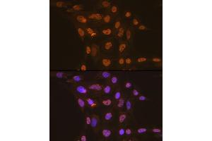 Immunofluorescence analysis of C6 cells using CDC16 Rabbit mAb (ABIN1678585, ABIN3017837, ABIN3017838 and ABIN7101525) at dilution of 1:100 (40x lens). (CDC16 Antikörper)