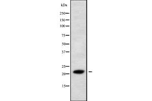 Western blot analysis IL28A using 293 whole cell lysates (IL28A Antikörper  (N-Term))