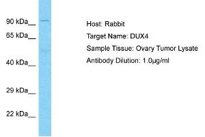 Host: Rabbit Target Name: DUX4 Sample Type: Ovary tumor lysates Antibody Dilution: 1. (DUX4 Antikörper  (N-Term))