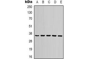Western blot analysis of GAPDH expression in 293T (A), NIH3T3 (B), rat brain (C), sheep muscle (D), rabbit testis  (E) whole cell lysates. (GAPDH Antikörper)