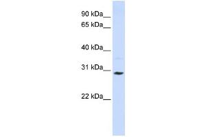 Western Blotting (WB) image for anti-Solute Carrier Family 25 (Carnitine/acylcarnitine Translocase), Member 20 (SLC25A20) antibody (ABIN2458773) (SLC25A20 Antikörper)