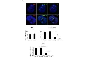 Immunofluorescence (Cultured Cells) (IF (cc)) image for anti-Ataxia Telangiectasia Mutated (ATM) (AA 1974-1988), (pSer1981) antibody (ABIN6656104)