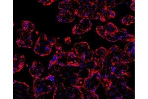 anti-Myeloid Differentiation Primary Response Gene (88) (MYD88) (AA 44-264) antibody