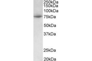 Western Blotting (WB) image for anti-Protein Arginine Methyltransferase 7 (PRMT7) (Internal Region) antibody (ABIN1108738) (PRMT7 Antikörper  (Internal Region))