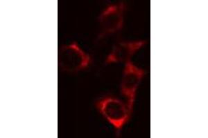 ABIN6274720 staining Hela cells by IF/ICC. (MRPS18C Antikörper  (Internal Region))