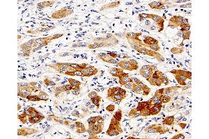Immunohistochemistry (Paraffin-embedded Sections) (IHC (p)) image for anti-Caspase 1 (CASP1) antibody (ABIN7249876)