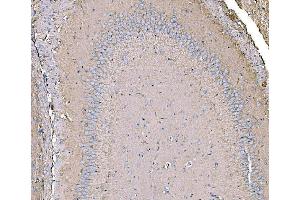 IHC analysis of IRBIT/AHCYL1 using anti-IRBIT/AHCYL1 antibody (ABIN7600030).