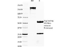 SDS-PAGE Analysis Purified FOXA1 Monoclonal Antibody (FOXA1/1541).