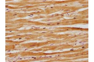 IHC image of ABIN7164419 diluted at 1:100 and staining in paraffin-embedded human heart tissue performed on a Leica BondTM system. (Deltex Homolog 3 Antikörper  (AA 90-347))