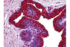 Anti-BCAS1 / NABC1 antibody IHC of human prostate.