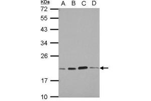 WB Image Sample (30 ug of whole cell lysate) A: A549 B: H1299 C: HCT116 D: MCF-7 12% SDS PAGE antibody diluted at 1:1000 (SKP1 Antikörper)