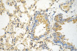 Immunohistochemistry was performed on paraffin-embedded mouse lung using AGL antibody (ABIN7797592), 1:200).