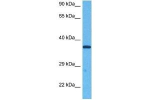 Host:  Rabbit  Target Name:  E2F5  Sample Tissue:  Human Jurkat Whole Cell  Antibody Dilution:  1ug/ml (E2F5 Antikörper  (N-Term))