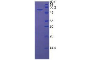 SDS-PAGE analysis of Rat HMWK Protein.