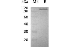 Western Blotting (WB) image for Activated Leukocyte Cell Adhesion Molecule (ALCAM) protein (Fc Tag) (ABIN7320462) (CD166 Protein (Fc Tag))