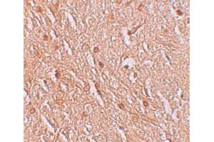 Immunohistochemical staining of human brain cells with LMBRD1 polyclonal antibody  at 2. (LMBRD1 Antikörper  (C-Term))