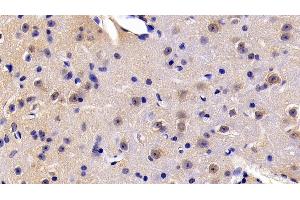 Detection of FADD in Mouse Cerebrum Tissue using Polyclonal Antibody to Fas Associating Death Domain Containing Protein (FADD) (FADD Antikörper  (AA 7-178))