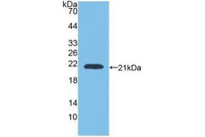Figure. (GAA Antikörper  (AA 70-225))