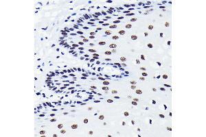 Immunohistochemistry (IHC) image for anti-TAR DNA Binding Protein (TARDBP) antibody (ABIN7270730)
