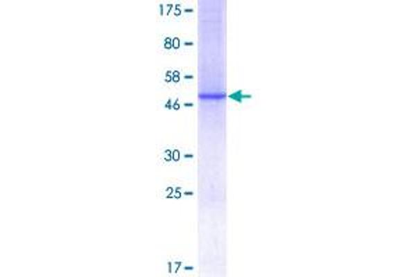 C1QC Protein (AA 1-245) (GST tag)