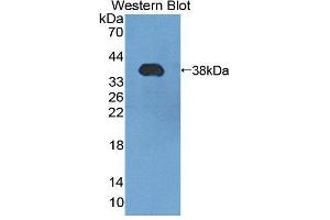 Western blot analysis of the recombinant protein. (PMM1 Antikörper  (AA 2-262))