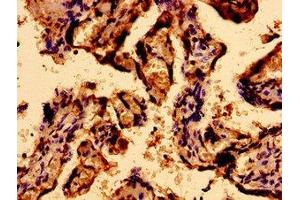 Immunohistochemistry of paraffin-embedded human placenta tissue using ABIN7168566 at dilution of 1:100 (Sacsin Antikörper  (AA 983-1150))