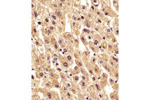 (ABIN6242565 and ABIN6578213) staining PGM1 in human liver tissue sections by Immunohistochemistry (IHC-P - paraformaldehyde-fixed, paraffin-embedded sections). (Phosphoglucomutase 1 Antikörper  (AA 469-501))