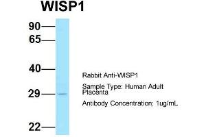 Host: Rabbit  Target Name: WISP1  Sample Tissue: Human Adult Placenta  Antibody Dilution: 1. (WISP1 Antikörper  (Middle Region))