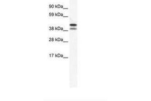 Image no. 1 for anti-TATA Box Binding Protein Like 2 (Tbpl2) (AA 53-102) antibody (ABIN202310) (Tbpl2 Antikörper  (AA 53-102))