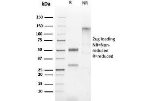SDS-PAGE Analysis of Purified HSP60 Rabbit Recombinant Monoclonal Antibody (HSPD1/2206R). (Rekombinanter HSPD1 Antikörper)