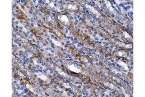 IHC analysis of SLC2A9 using anti-SLC2A9 antibody (ABIN7602338).