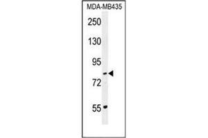Western blot analysis of PCDHGA1 Antibody (Center) in MDA-MB435 cell line lysates (35ug/lane).