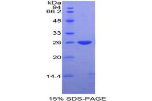 SDS-PAGE analysis of Mouse DIXDC1 Protein. (DIXDC1 Protein)