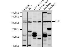 Western blot analysis of extracts of various cell lines, using AHR antibody (ABIN3015499, ABIN3015500, ABIN5663909 and ABIN6218543) at 1:1000 dilution. (Aryl Hydrocarbon Receptor Antikörper  (AA 619-848))
