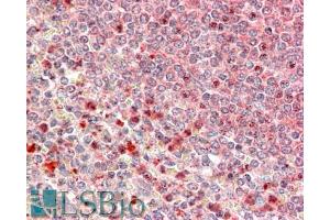 ABIN570777 (5µg/ml) staining of paraffin embedded Human Spleen. (UBR4 Antikörper  (C-Term))