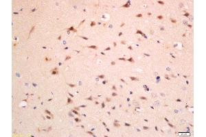 Immunohistochemistry (Paraffin-embedded Sections) (IHC (p)) image for anti-Complement Component 1, Q Subcomponent, C Chain (C1QC) (AA 81-180) antibody (ABIN1386519)