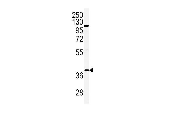 Adiponectin Receptor 2 Antikörper  (AA 45-72)