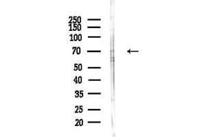 Western blot analysis of lysates from  cells(heat-shock,45 min treatment), using Phospho-NF2 / Merlin (Ser518) Antibody at 1/1000 dilution.