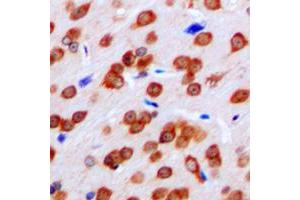 Immunohistochemical analysis of FPR1 staining in human brain formalin fixed paraffin embedded tissue section. (FPR1 Antikörper  (Center))