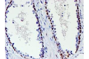 Image no. 2 for anti-WW Domain Containing Transcription Regulator 1 (WWTR1) antibody (ABIN1501763) (WWTR1 Antikörper)