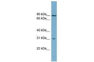 ABCD2 antibody used at 1 ug/ml to detect target protein. (CCL17 Antikörper)