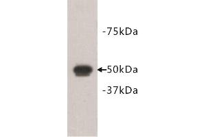 Western Blotting (WB) image for anti-FAT Tumor Suppressor Homolog 1 (FAT1) antibody (ABIN1854969) (FAT1 Antikörper)