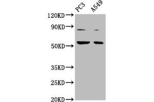 Western Blot Positive WB detected in: PC-3 whole cell lysate, A549 whole cell lysate All lanes: ARX antibody at 1:2000 Secondary Goat polyclonal to rabbit IgG at 1/50000 dilution Predicted band size: 59 kDa Observed band size: 59 kDa (Arx Antikörper  (AA 381-460))