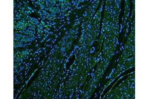 IF analysis of CD39/ENTPD1 using anti-CD39/ENTPD1 antibody (ABIN7602461). (CD39 Antikörper  (AA 79-411))